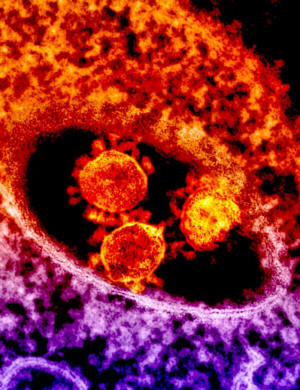 Corona Virus